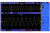 картинка Цифровой осциллограф DSO5072P, 2х70МГц, 40K точек от интернет магазина Radiovip